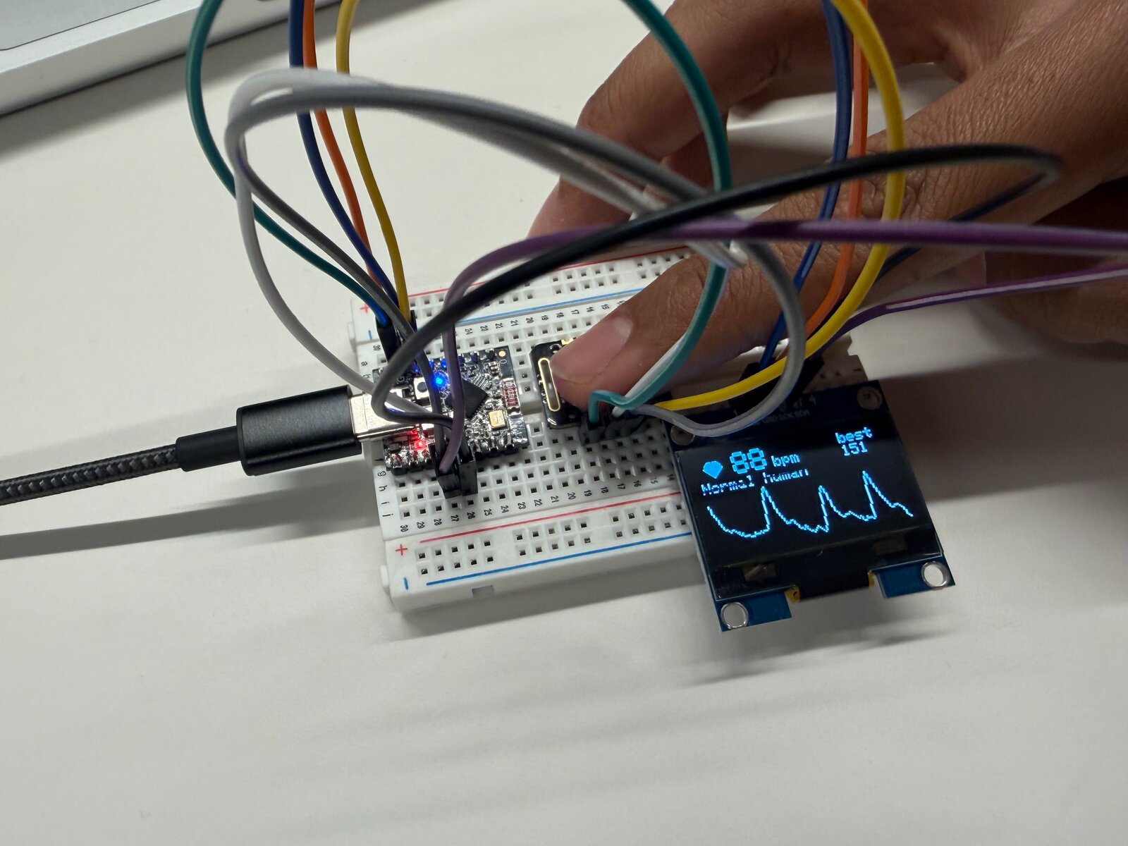 A breadboard heartbeat monitor with an OLED screen showing 88 bpm and a pulse waveform